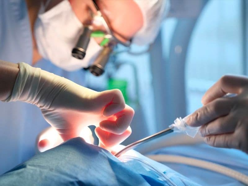 Bademcik Ameliyati Hizli Ve Kanamasiz Yontemler - Dr. Oray Karacayli